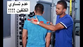 Uneven shoulders .. عدم تساوي الكتفين