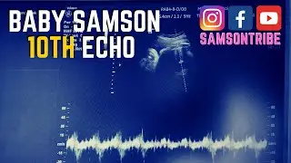 Baby Samson 10th Echo Midwife Appointment (Vroedvrouw)