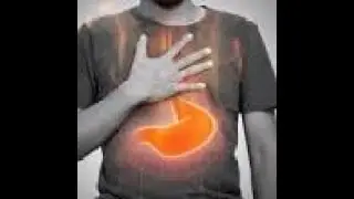 GERD/Dubbed: हिन्दी/Heart burn/ Chest burn/ Home remedies/ treatment