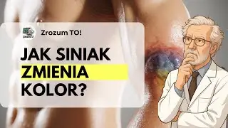 Why Does a Bruise Change Color? Rainbow Under the Skin