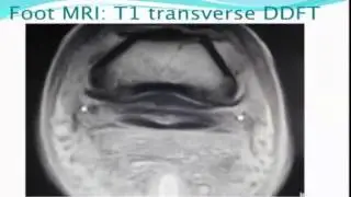 Diagnosing Horse Lameness - Part 5
