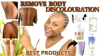 How To Treat Discolouration, Uneven Skin Tone | Body Edition