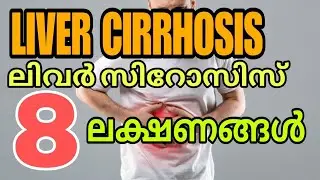 Liver cirrhosis symptoms malayalam | liver diseases #livercirrhosis ##livercondition #liver