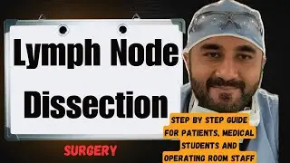 What to Expect for Robotic Lymph Node Dissection Surgery 😳(Step by step guide) Must See 👀 ❤️