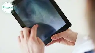 Is RADIATION safe for Human Body? #ctmrihub #ctscanradiation #radiationsafety #hospitals #medicalhub