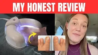 Fungabeam Review &ndash; LEGIT OR SCAM? Fungabeam Review - Fungabeam Nail Fungus Device