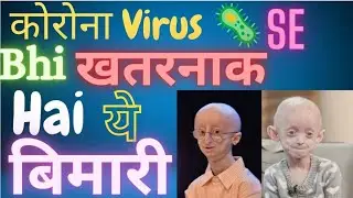 Corona Virus se bhi khatarnak hai ye bimari 😳