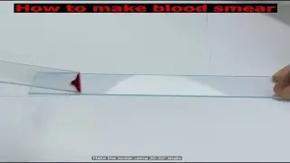 LEISHMAN STAINING | Blood Smear Staining Technique | Heamatology #labtest #labtesting #science