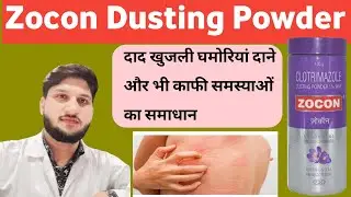 Zocon Dusting Powder Use Dose side effects Benefits How to use Honest Review