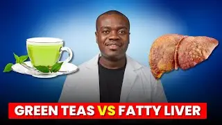 What Happens to Your Liver When You Drink Green Tea?