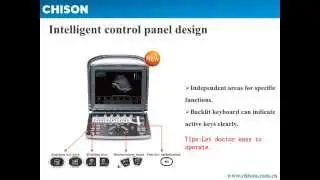 ECO1 Product Introduction Chison Portable Ultrasound- Most affordable,no competition in USA market