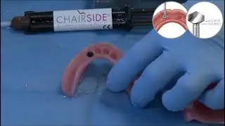 Clinical Demonstration Live Clinical Demonstration of CHAIRSIDE Denture Prep & Polish Kit