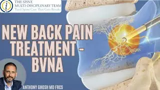 Chronic Low Back Pain Relief: What Is Basivertebral Nerve Ablation (BVNA)