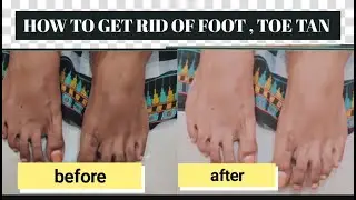 HOW TO REMOVE TAN FROM FEET, TOE WITH THIS SINGLE STEP||NO PEDICURE ||100%EFFECTIVE||TRIM NAILS p2