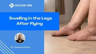 Swelling In The Legs After Flying?! When Should You Be Concerned?