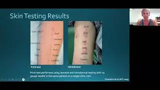 Alpha-Gal Meat Allergy with Erin McGintee, MD