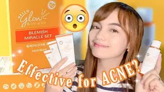 HELLO GLOW BLEMISH MIRACLE SET EFFECTIVE FOR ACNE? | ITSMEJOWN