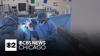 Chicago man is awake throughout kidney transplant surgery at Northwestern