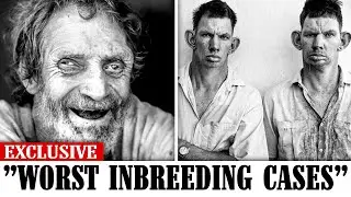 17 WORST Cases of Incest & Inbreeding In History...