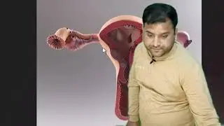 Truth About Nasbandi No One Talks About &ndash; Medical Student Explains&rdquo;