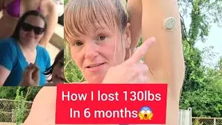 How food almost killed me & put me in the ICU for 3 months