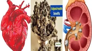 DR.RJ Healthy health Benefit Of Kalpasi Stone Flowers?