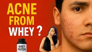 Whey Protein se Acne Hota Hai? Science kya kehti hai &ndash; Research ka Sach!