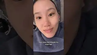 I got the cheapest facial in Korea