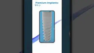 Streamline Dental Implant Orders: The Ultimate Mobile App for Dental Clinics!