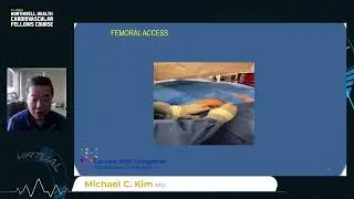 Femoral Access With Ultrasound Guided approach in PCI/angiogram with Video Demo, lecture