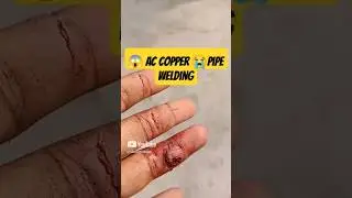 AC Technician Accident | Real Clip😭 #post #trending #ytshorts #splitac #copper #viral #shorts