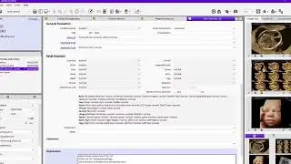 ViewPoint 6 ultrasound reporting for OBGyn - A Verisound digital solution