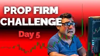 DayTrading | This Video Could Change Your Life | Prop Firm Challenge | Day 5