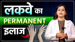 Paralysis Treatment Reality | क्या लकवे का Permanent इलाज संभव है? | Explained By Dr Pragti Gupta
