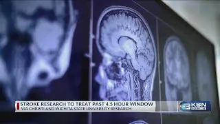 Via Christi: Brain imaging technology could extend stroke treatment window