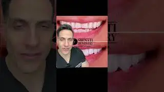 Do you want a nicer smile to increase confidence?