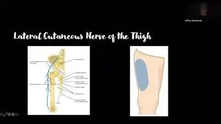 Dr. Jeffrey Strakowsky talks about ultra high frequency Ultrasound of LE Nerves
