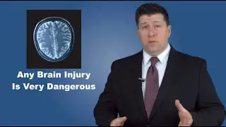 Chicago Brain Injury Attorneys - What YOU Need To Know If You Suspect a Brain Injury.