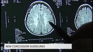New study details concussion guidelines