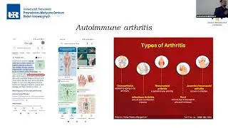 The immune response in the autoimmune arthritis - are we always on the same page?