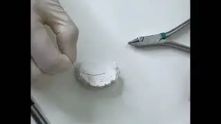 Contenção fixa superior com dobras de V-bend