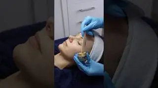 Dermamelan&reg; Depigmentation & Melasma Treatment