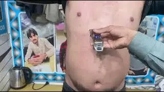 🔥 *Before & After: Easy Chest Hair Removal for Men 🥵