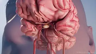 Pituitary Tumor Surgery Saves High School Football Coach - UNC Neurosurgery