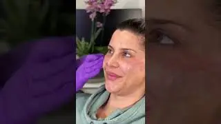 How CBD Has Changed My Plastic Surgery Practice | Dr. Kian