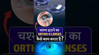 ORTHO-K lens : Clear vision without surgery with demonstration | Akash Vlogs | full video