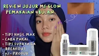 REVIEW + TIPS CARA PAKAI MS GLOW HASIL MAX  😳