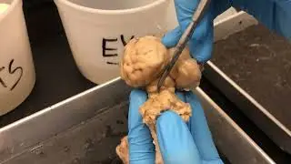 Dorsal View of Sheep Brain (Anatomy & Physiology I &ndash; BIO)