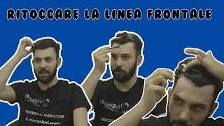 11. Ritoccare la linea frontale
