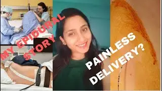 My Epidural Experience | Epidural Risks | Painless Delivery | My Normal Delivery Story | Vlog